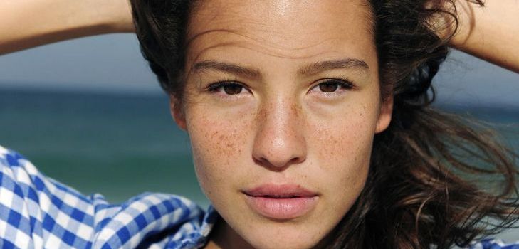 कैसे हमेशा freckles से छुटकारा पाने के लिए: घर पर सिद्ध साधन