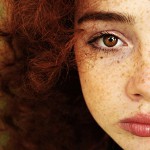 कैसे freckles से छुटकारा पाने के लिए?