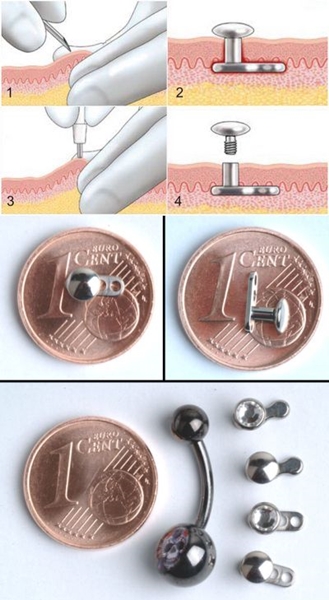 Microdermal भेदी: कैसे microdermabras बना रहे हैं (फोटो)
