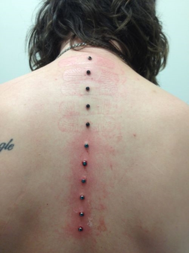 Microdermal भेदी: कैसे microdermabras बना रहे हैं (फोटो)